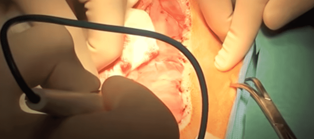 Maxillectomy with Carotid Ligation Dog Surgery