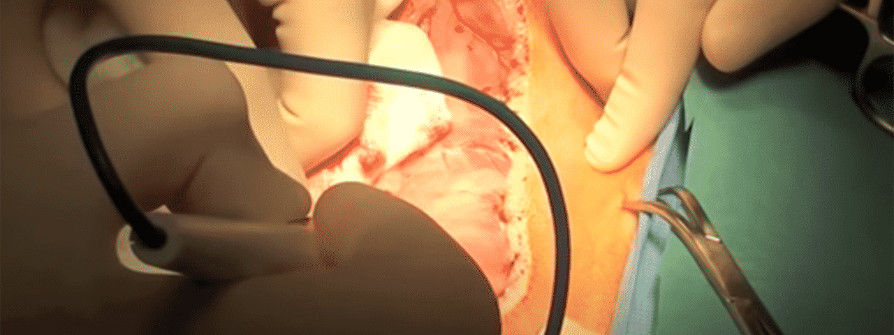 Maxillectomy with Carotid Ligation Dog Surgery